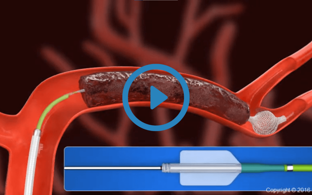 Portfolio: 3D Healthcare Animation of Medical eLearning Videos | EFFE Animation