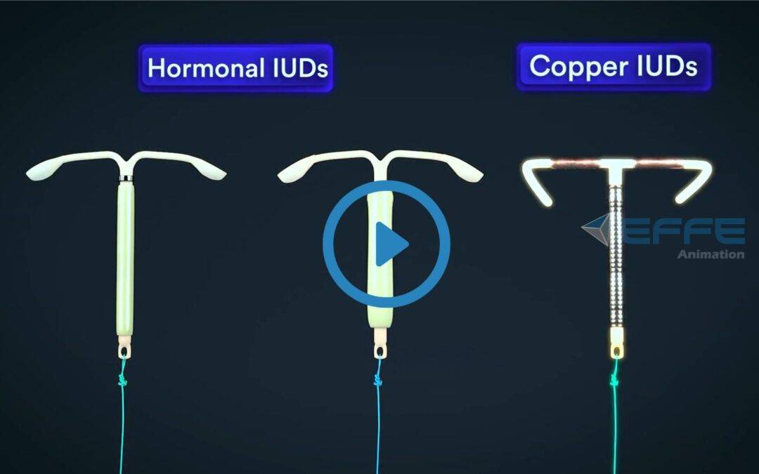 Portfolio: 3D Animation Video of Intrauterine Devices Demystifying (IUDs) : 3D Medical Animation Company
