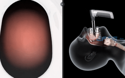 Portfolio: Enhancing Airway Management Training with 3D Biomedical Device Animation Video