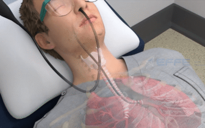 Portfolio: Visualizing Airway Procedures with 3D Bronchoscope Device Animation Videos