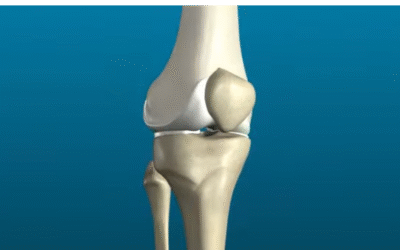 Portfolio: Simplifying Orthopedic Procedures with 3D Knee Surgery Animation