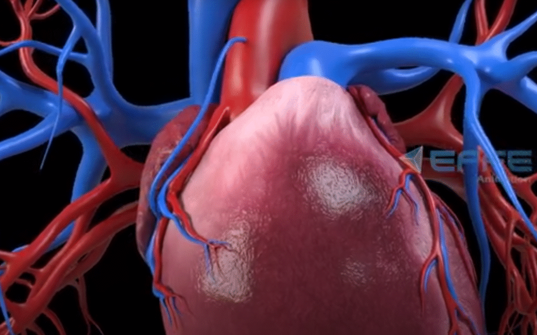 Cardiovascular Surgery Animation company