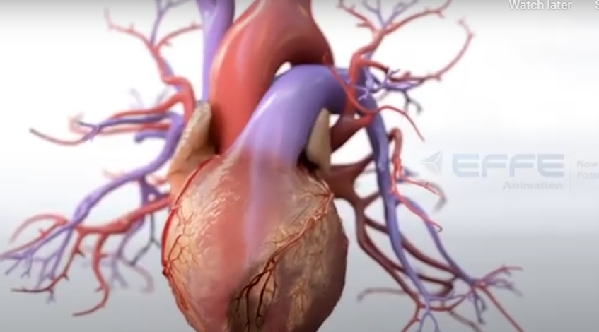 Portfolio: Bringing the Heart to Life with Cardiovascular Disease Mechanism Animation