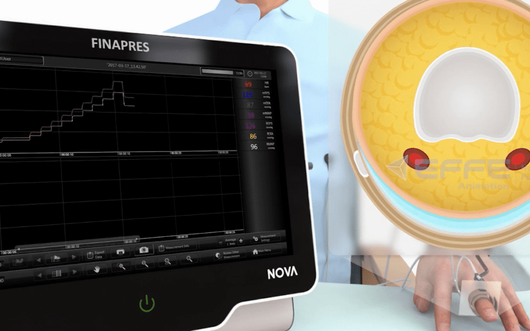 Portfolio: Enhancing Healthcare Education with 3D Monitoring Devices Animation Video