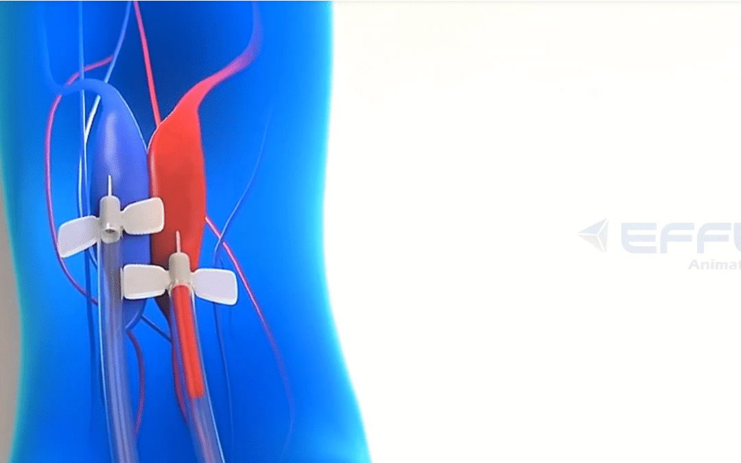 Portfolio: Revolutionizing Nephrology Training with 3D Renal Devices Animation Video