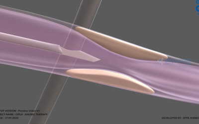 Portfolio: Simplifying Surgical Concepts Through Precision 3D Visualization