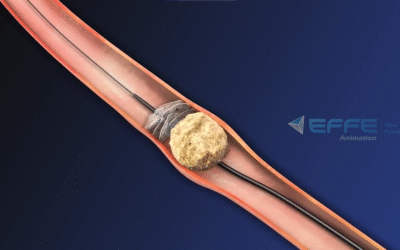 Portfolio: Simplifying Surgical Concepts Through Precision 3D Visualization