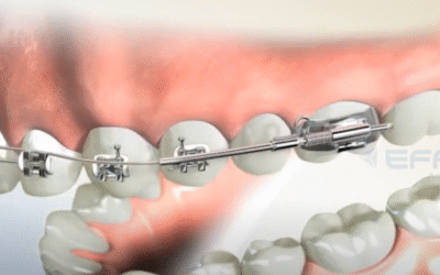 Portfolio: 3D Dental Videos: Visualizing Orthodontic Treatments with Precision and Clarity