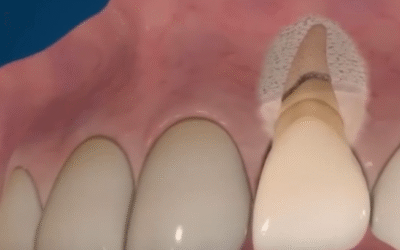 Portfolio: Dental Surgery Animated Videos Redefining 3D Learning for Oral Surgery Training