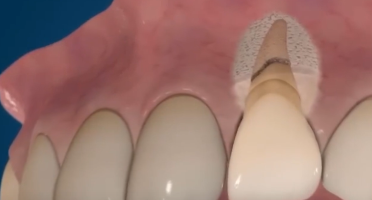 Dental animated videos