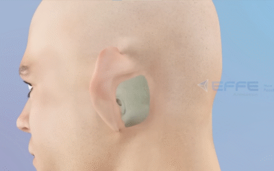 Portfolio: Simplifying Complex ENT Procedures Through Advanced Medical Animation