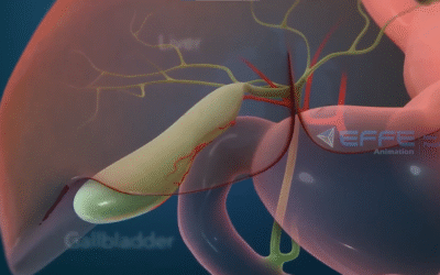 Portfolio: Discover the Future of Surgery with Laparoscopic Laser Surgery Animation